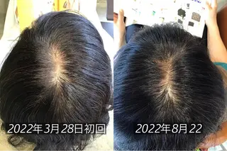 ショート エイジングケア特化 サーカス/育毛/スパのヘアスタイル