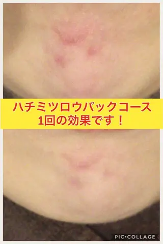 ショート カラー パーマ ヘアアレンジ メンズ キッズ ネイル マツエク・マツパ ニキビ・肌質改善専門 ♡人生が変わるサロンのエステ・リラクイメージ