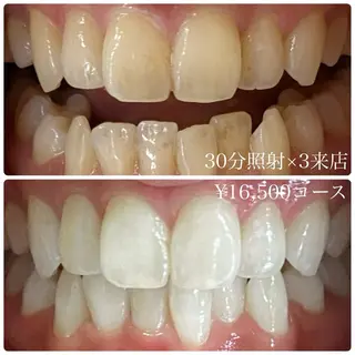 PLATINUM Beauty 横浜店所属・ホワイトニングルーム 横浜店のその他イメージ