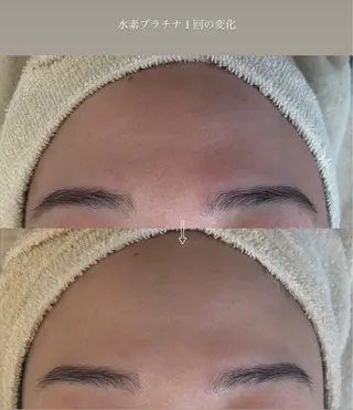 anthes /MIHOのエステ・リラクイメージ