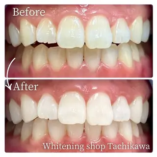 セルフ ホワイト ニングショップ立川のその他イメージ