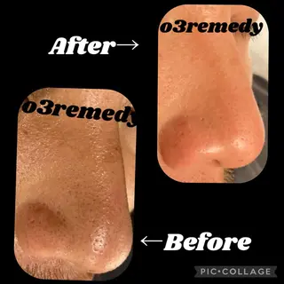 o3remedy所属・宇野澤 彩加のエステ・リラクイメージ