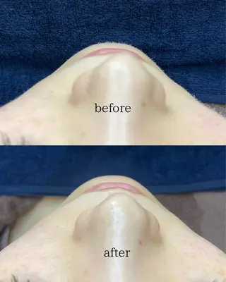 アイブロウ Naps-Shaving所属・敏感肌⭐️ シェービング専門佐藤の眉毛・アイブロウイメージ