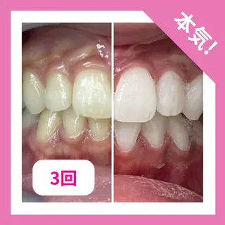 お肌と歯のサロン　Sona Mior所属・藤井 ののみのエステ・リラクイメージ