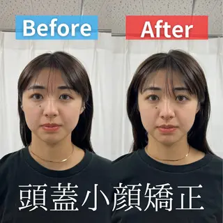 KOGAO STUDIO所属・モテギ ハルトのエステ・リラクイメージ