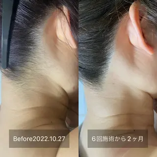 港区都度払い脱毛 miranjuのエステ・リラクイメージ