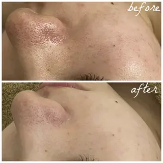 メンズ メナード岐阜市茜部 杉浦のエステ・リラクイメージ