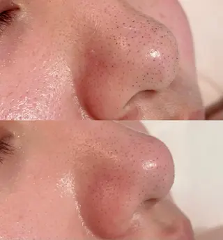 mignon /まつげパーマ/眉毛のエステ・リラクイメージ