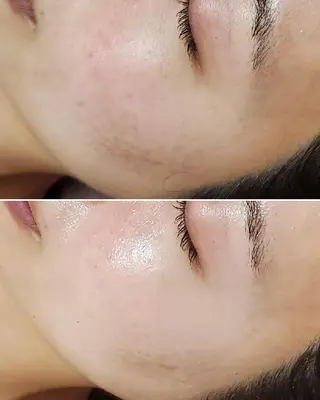 ALOHA RETREATのエステ・リラクイメージ