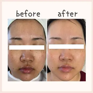 中澤 夢華のエステ・リラクイメージ