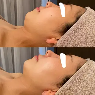 田中For..天王寺 肌質改善/よもぎ蒸しのエステ・リラクイメージ