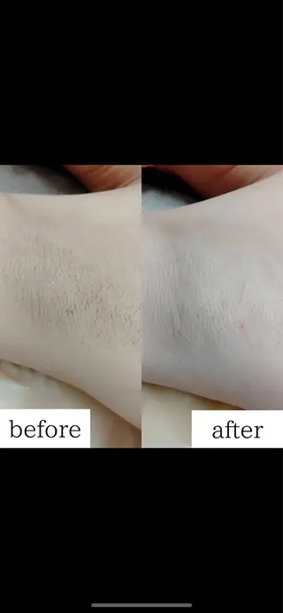 メンズ キッズ みんなの脱毛 TSURURINの眉毛・アイブロウイメージ