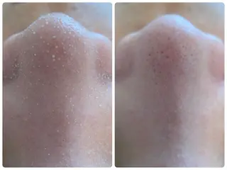 Hisui 小出のエステ・リラクイメージ