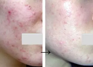 自爪育成ネイルサロン ココリュバンのネイルデザイン