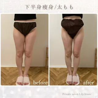 Lily branc 痩身/小顔/肌質改善のエステ・リラクイメージ