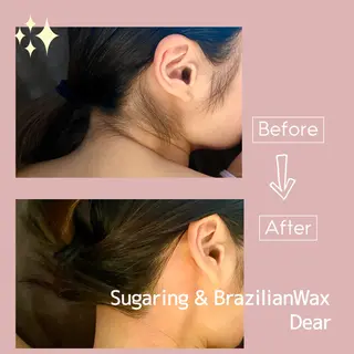 シュガーリングサロン Dearのエステ・リラクイメージ