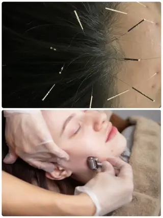 表参道鍼灸院K 美容鍼🔮ララピールのエステ・リラクイメージ