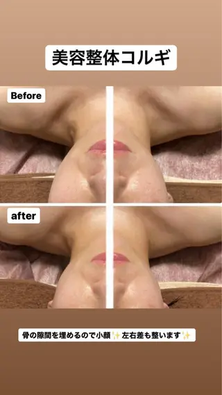 美顔秘密基地新宮所属・美顔秘密基地 新宮のその他イメージ