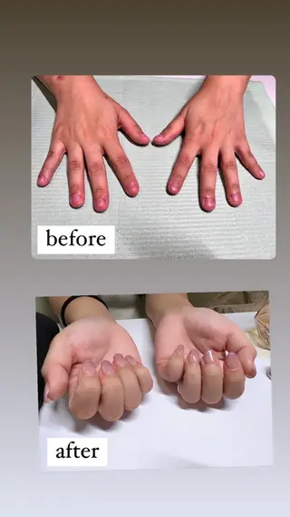 メンズ ネイル 爪ケア/深爪 自爪育成 🐰えむのネイルデザイン