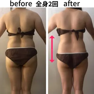 小顔・痩身専門店 Sunao所属・小顔.足痩せ整体 痩身天六Sunaoのその他イメージ