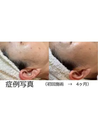 シミ・若返り特化 さゆみのエステ・リラクイメージ