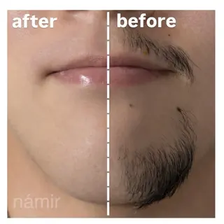 メンズ ブラジリアンワックス＋光脱毛専門店námir【ナミル】所属・ブラジリアンワックス ＆光脱毛námirのエステ・リラクイメージ