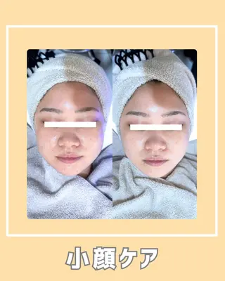 |ピーリング・毛穴| soina神楽坂のエステ・リラクイメージ