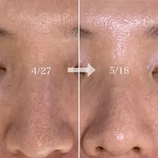 シェノン所属・ニキビ・毛穴・ フェイシャル専門店のその他イメージ