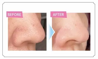 BeTOWA所属・BeTOWA wax脱毛/眉の眉毛・アイブロウイメージ