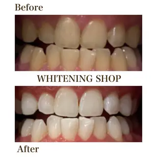 ホワイトニング ショップ川越店のエステ・リラクイメージ