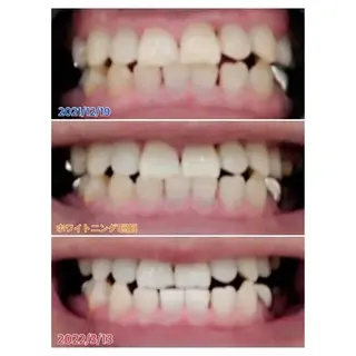 M渋谷店所属・M渋谷 ホワイトニングのエステ・リラクイメージ