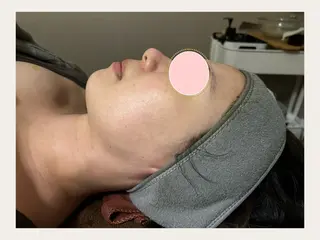 肌質改善 ルポエトワのエステ・リラクイメージ