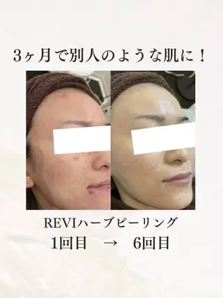 chou cherie所属・🌈肌質改善サロン. manami🌈のエステ・リラクイメージ