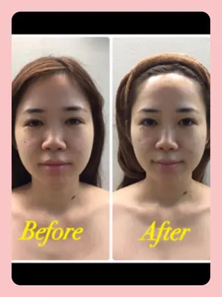 DeCoLé Beauty所属・艶肌/敏感肌/若さ/ ボディ痩身🌿のエステ・リラクイメージ