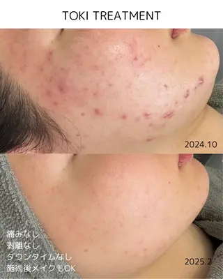 Moonsun kaho豊田市のエステ・リラクイメージ