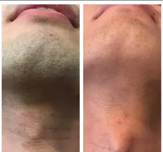 メンズ INFINITY 神戸店のエステ・リラクイメージ