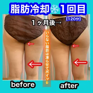 痩身/脱毛/ネイル HARUKAのエステ・リラクイメージ