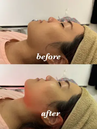 メンズ 腸活サポート みなみののエステ・リラクイメージ