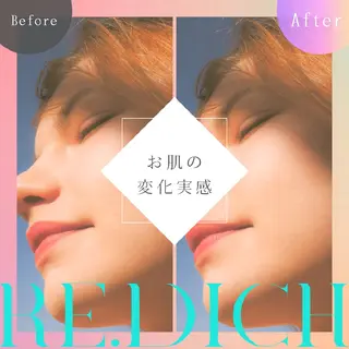 🟡レディース シェービングサロン/のエステ・リラクイメージ