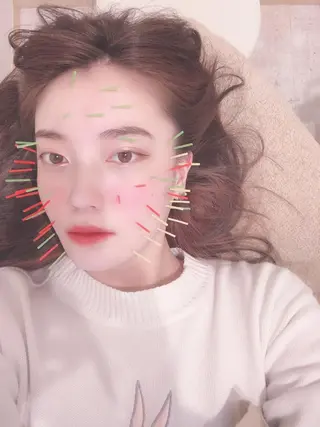 鍼灸整骨院Refine所属・鍼灸 Refineのその他イメージ