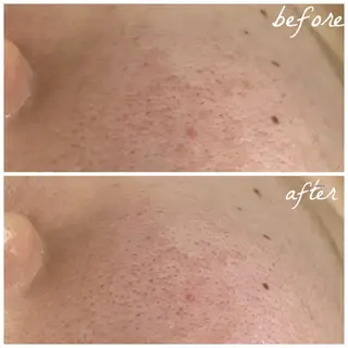 メンズ メナード岐阜茜部 杉浦のエステ・リラクイメージ