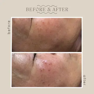 emiluka beautyのエステ・リラクイメージ