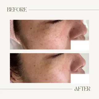 CEsalonEgg 齋藤のエステ・リラクイメージ