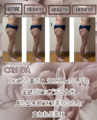 ヴィーナス ビューティーのエステ・リラクイメージ