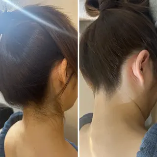 うなじ脱毛/美肌脱毛 LABELのエステ・リラクイメージ