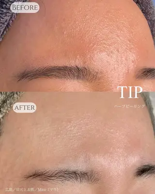 Mau beauty salon所属・Mau (マウ)のエステ・リラクイメージ