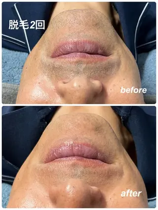 メンズ blue.【都度払い脱毛&フェイシャルサロン】所属・blue.💙【 脱毛&フェイシャル】のエステ・リラクイメージ