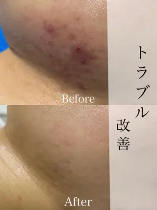 森田(南) 真子のエステ・リラクイメージ