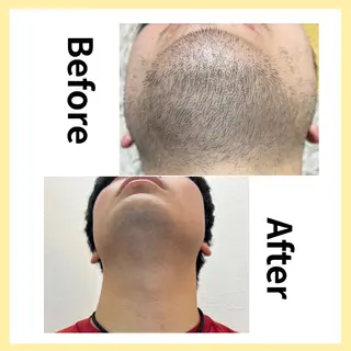 セルフ脱毛/美尻イス キングスサロン熊本のエステ・リラクイメージ