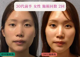 美容とカラダの鍼灸 サロン やなけんのエステ・リラクイメージ